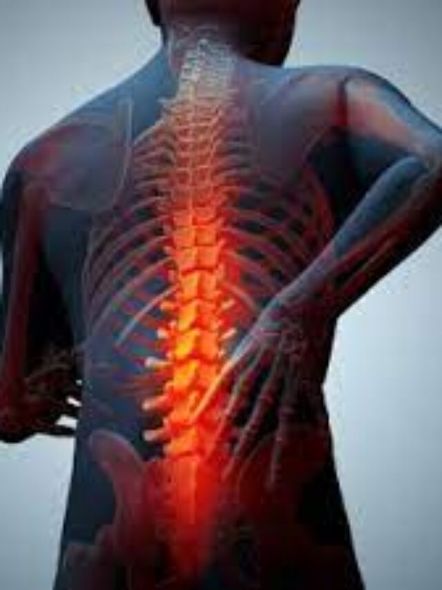 5 Strengthening Exercises for Lower Back Pain